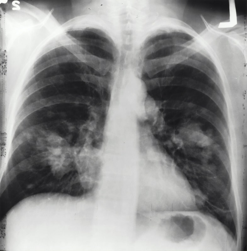 Cosa vuol dire svapare di polmoni?